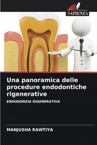panoramica delle procedure endodontiche rigenerative
