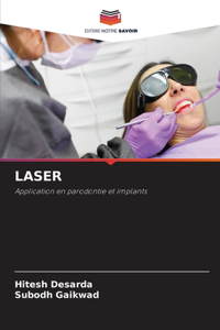 Laser