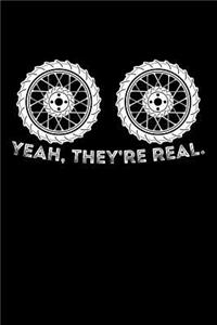 Yeah, They Are Real.