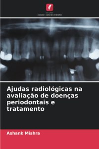 Ajudas radiológicas na avaliação de doenças periodontais e tratamento