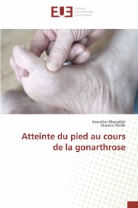 Atteinte du pied au cours de la gonarthrose