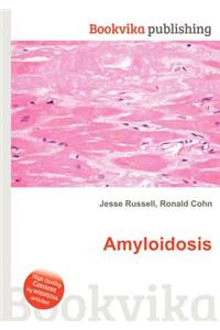 Amyloidosis
