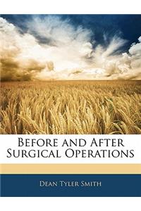 Before and After Surgical Operations