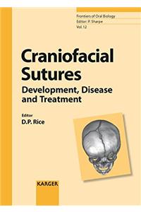 Craniofacial Sutures