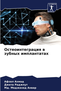 Остеоинтеграция в зубных имплантатах