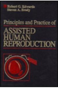 Principles and Practice of Assisted Human Reproduction