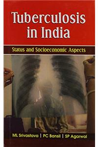 Tuberculosis in India