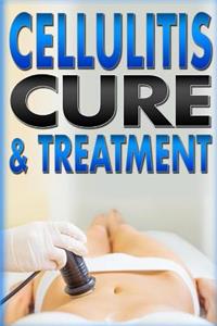 Cellulitis Cure & Treatment