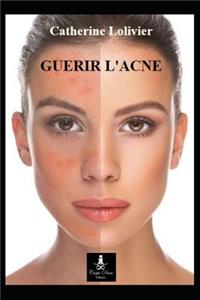 Guerir l'Acne