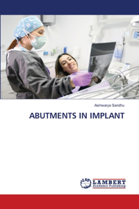 Abutments in Implant