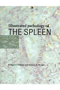 Illustrated Pathology of the Spleen