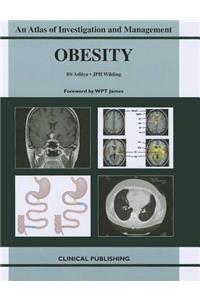 Obesity: An Atlas of Investigation and Management