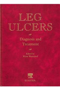 Leg Ulcers: Diagnosis and Treatment