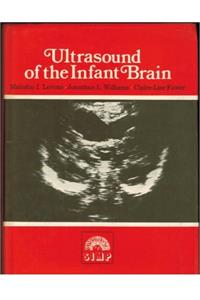 Ultrasound Inf Brain Cdm 92