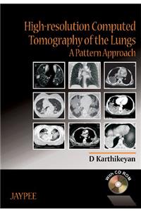 High-Resolution Computed Tomography of the Lungs: A Pattern Approach with CD-ROM