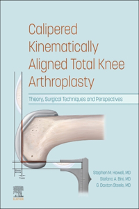 Calipered Kinematically Aligned Total Knee Arthroplasty E-Book