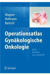 Operationsatlas Gynäkologische Onkologie