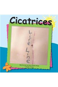 Cicatrices