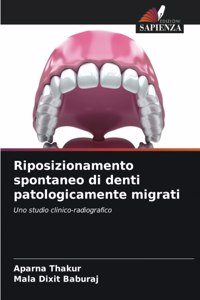 Riposizionamento spontaneo di denti patologicamente migrati