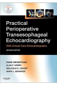 Practical Perioperative Transesophageal Echocardiography