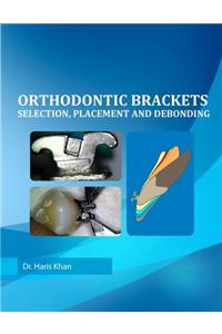 Orthodontic Brackets