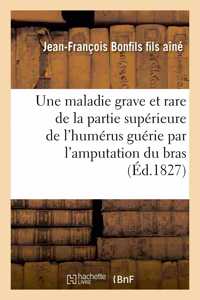 Description Succincte d'Une Maladie Grave Et Rare de la Partie Supérieure de l'Humérus