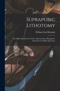 Suprapubic Lithotomy