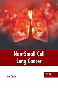 Non-Small Cell Lung Cancer