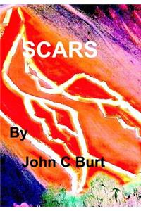 Scars