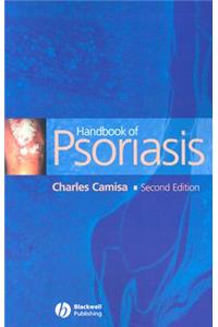 Handbook of Psoriasis