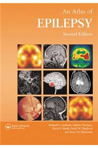 Atlas of Epilepsy
