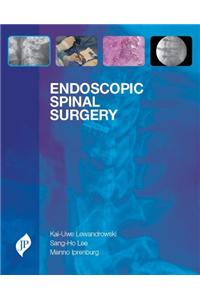 Endoscopic Spinal Surgery