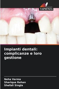 Impianti dentali