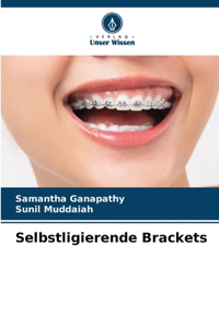 Selbstligierende Brackets