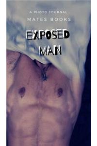 Exposed Man