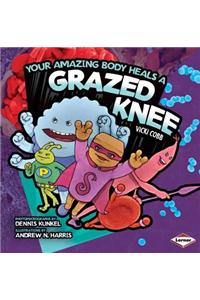 Your Amazing Body Heals a Grazed Knee