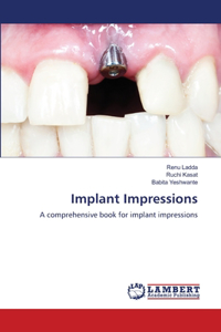 Implant Impressions