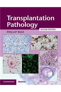 Transplantation Pathology Hardback with Online Resource