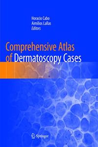 Comprehensive Atlas of Dermatoscopy Cases