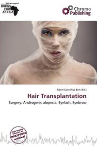 Hair Transplantation