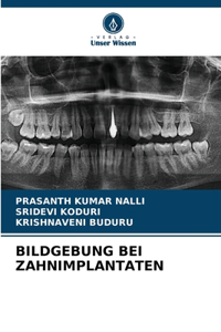 Bildgebung Bei Zahnimplantaten