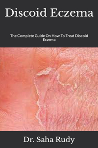 Discoid Eczema