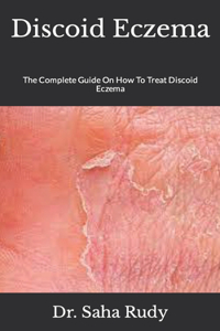 Discoid Eczema