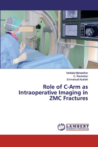 Role of C-Arm as Intraoperative Imaging in ZMC Fractures