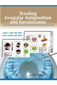 Treating Irregular Astigmatism and Keratoconus