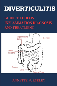 Diverticulitis