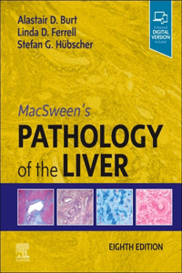 Macsween's Pathology of the Liver