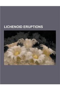 Lichenoid Eruptions: Annular Lichen Planus, Atrophic Lichen Planus, Bullous Lichen Planus, Drug-Induced Lichenoid Reaction, Erythema Dyschr