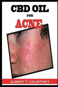 CBD Oil for Acne: Everything You Need to Know about the CBD Oil (the Perfect Remedy for Acne)