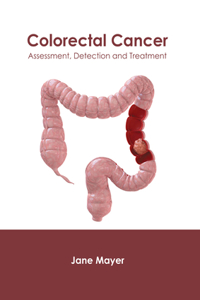 Colorectal Cancer: Assessment, Detection and Treatment